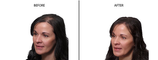 Deana